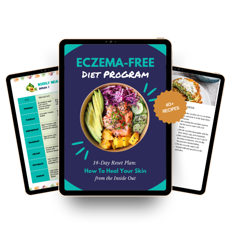 Eczema-Free Diet Program: 14-Day Reset Plan