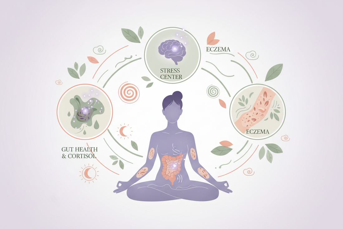 why stress can amplify flare-ups