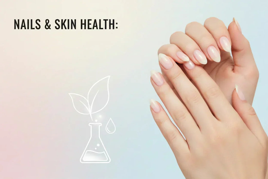 What your nails say about your skin and eczema