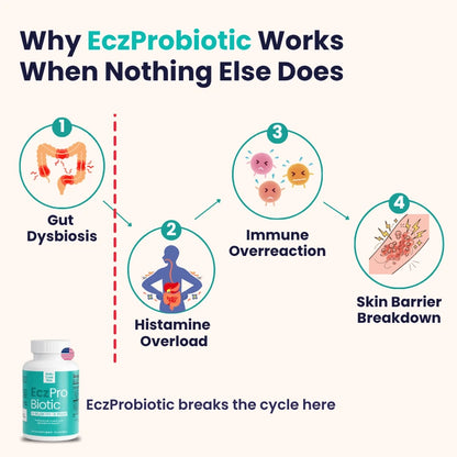 Kill Eczema at the Root Protocol