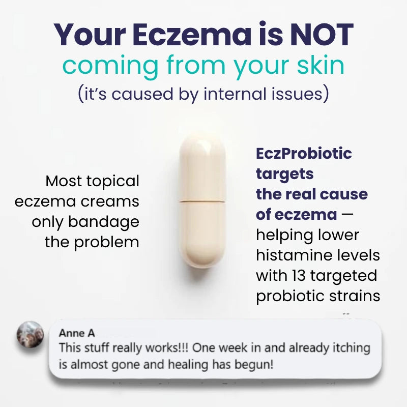 Kill Eczema at the Root Protocol