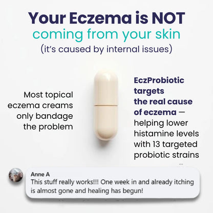 Kill Eczema at the Root Protocol